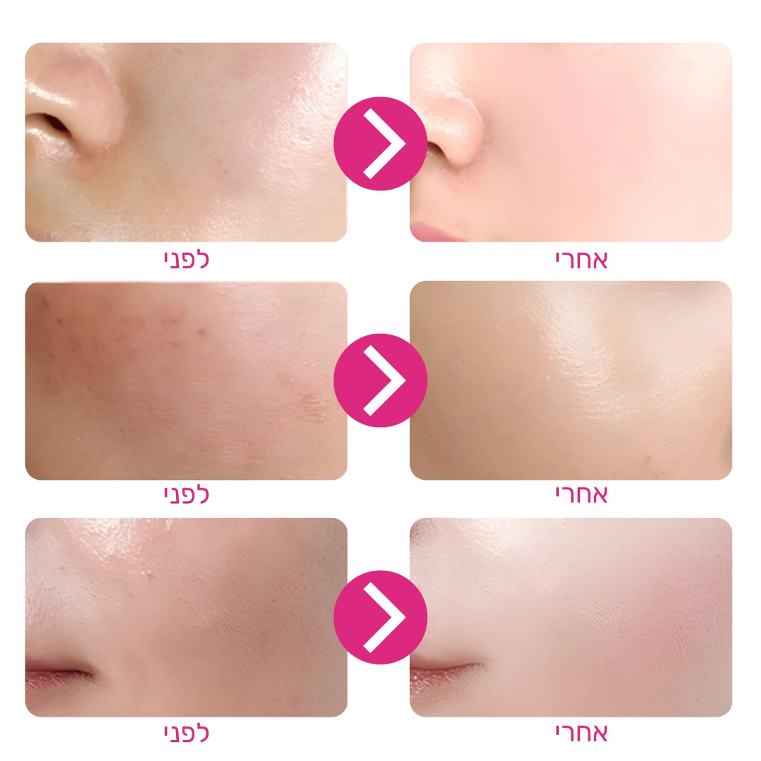 מסכת קולגן מתקלפת לעור הפנים של ByNibar