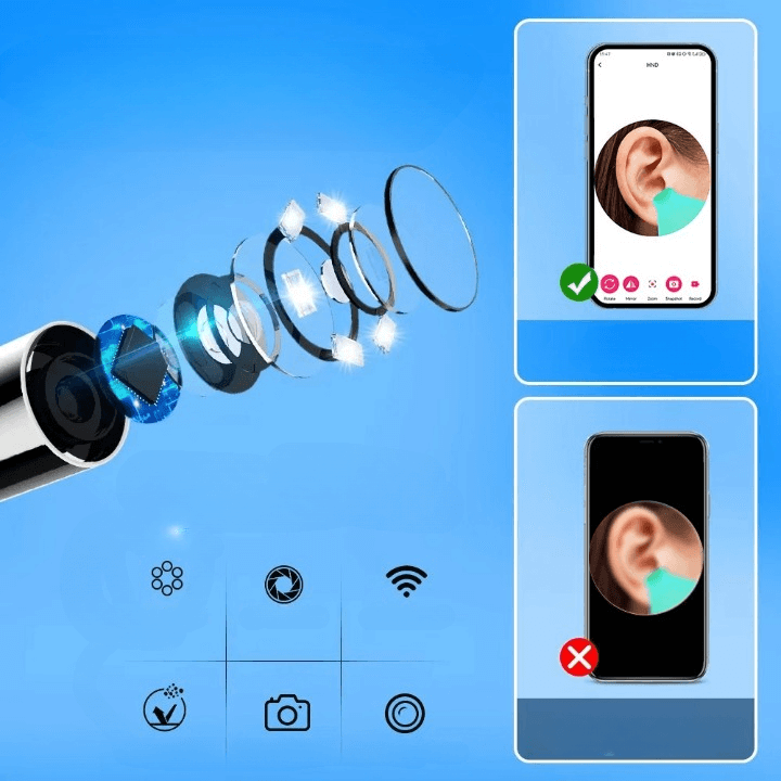 מנקה אוזניים עם מצלמה חכמה של ByNibar