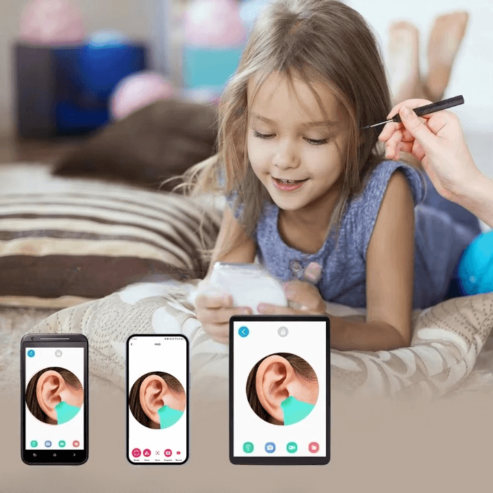 מנקה אוזניים עם מצלמה חכמה של ByNibar