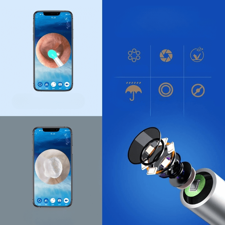 מנקה אוזניים עם מצלמה חכמה של ByNibar