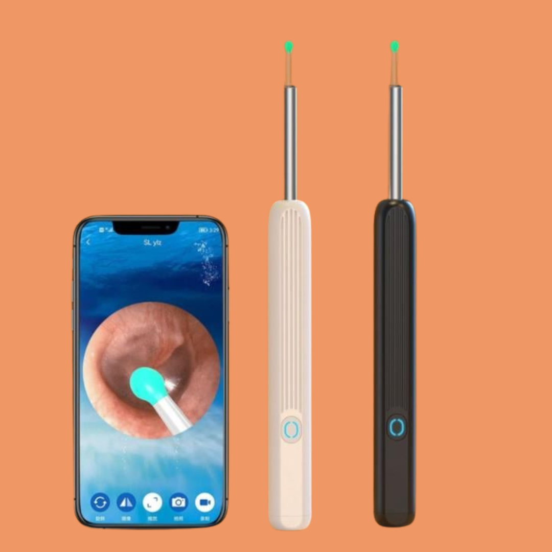 מנקה אוזניים עם מצלמה חכמה של ByNibar