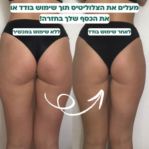 מכשיר להעלמת צלוליטיס של ByNibar