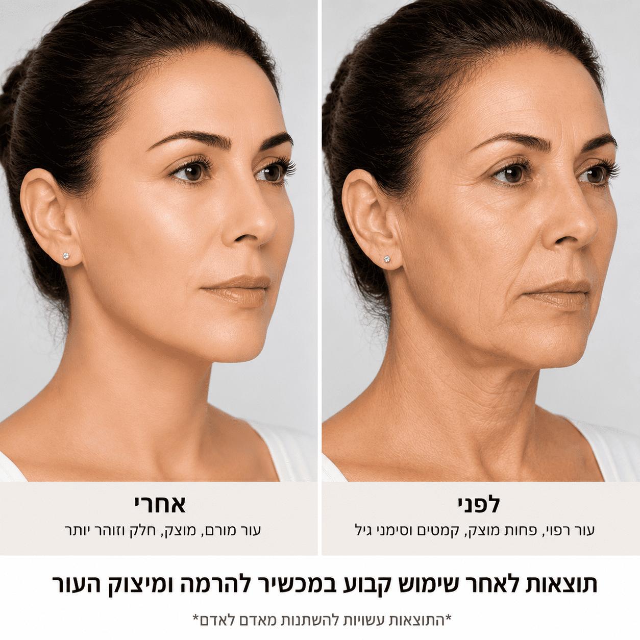 מכשיר להרמה ומיצוק עור הפנים והצוואר ByNibar Glow