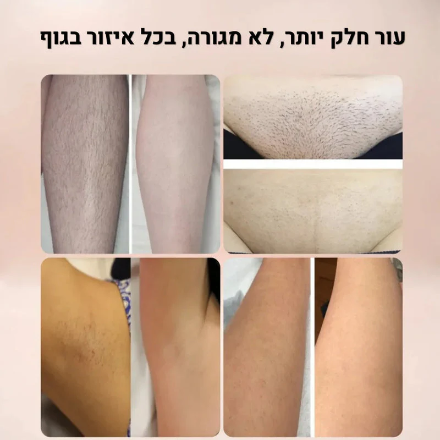 מכונת הגילוח 2 ב-1 של ByNibar