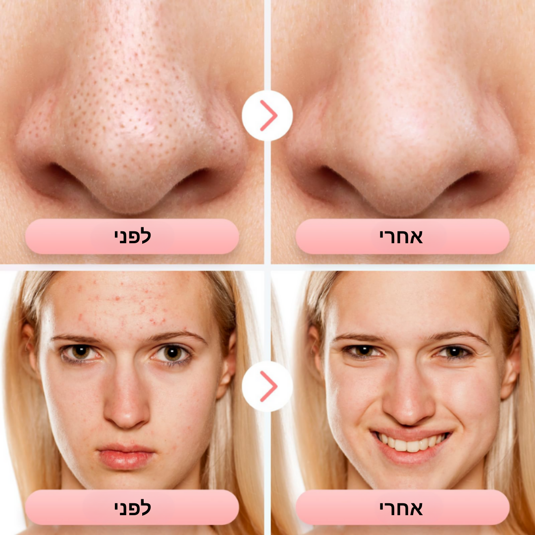 מכשיר לניקוי פנים עמוק של ByNibar