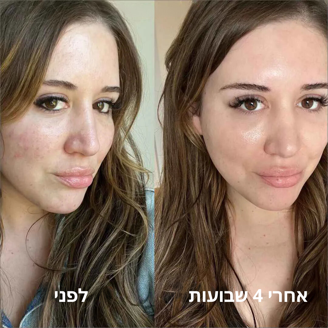 מסכת קולגן לילה לעור חלק של ByNibar